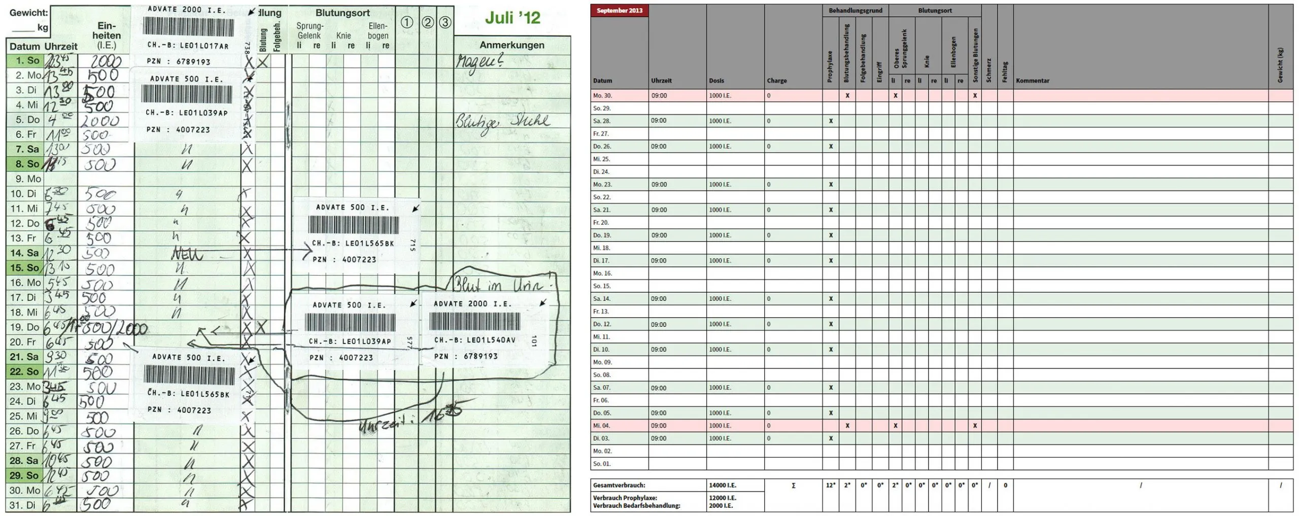 Comparison of two diaries: on the left a handwritten paper diary, on the right the overview view in smart medication eDiary